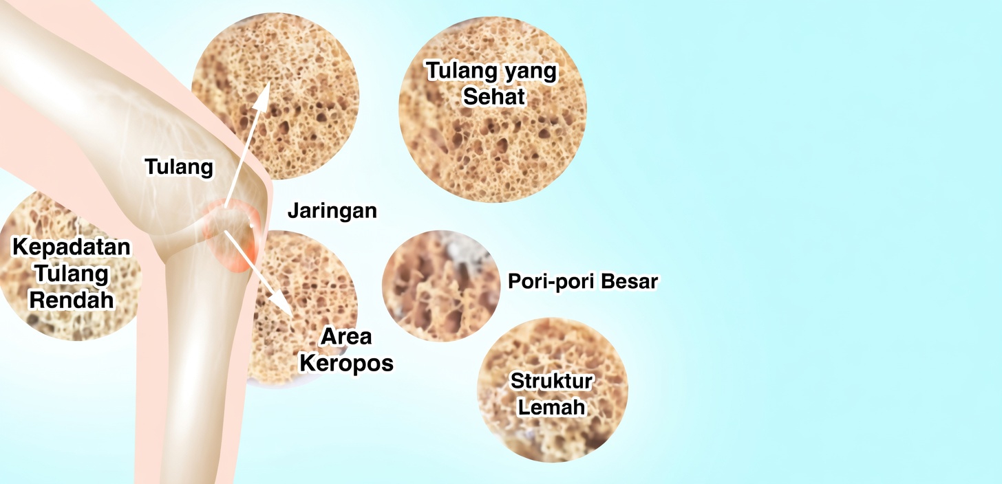 Latihan Terbaik untuk Usia 50-an, 60-an, 70-an—dan Seterusnya